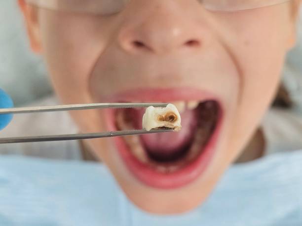 Best Emergency Treatment for Toothache in Highlands, NC